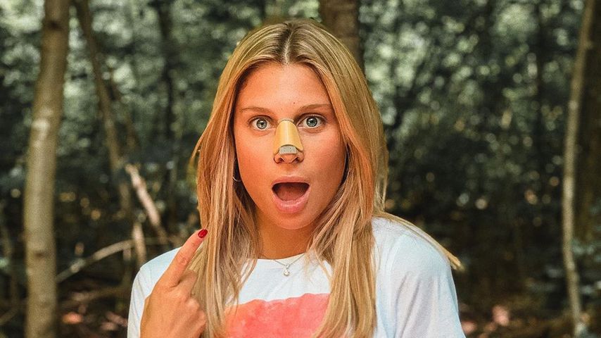 Beauty-OP: Raúl Richters Freundin Vanessa hat eine neue Nase