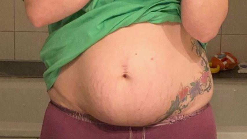 Vanessa Schneiders Bauch nach der Geburt, Dezember 2020
