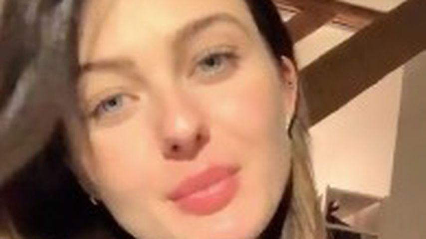 Sie steht dazu! GNTM-Vanessa ließ sich Lippen aufspritzen