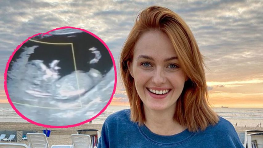 Baby schon so groß? Vanessa Tamkan flasht mit Ultraschall!