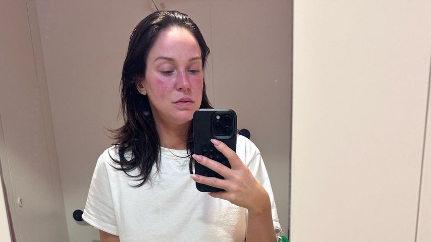 Nach Krankenhaus-Schock: Vicky Pattison ist wieder zu Hause
