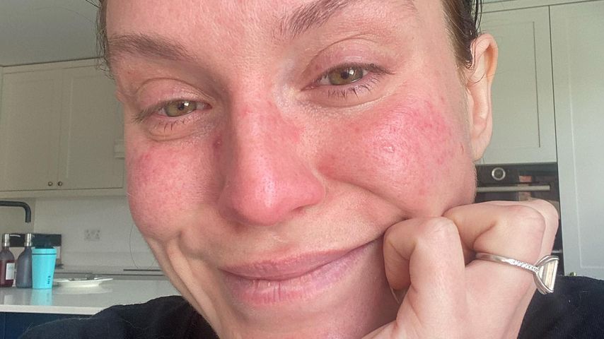 Vicky Pattison unter Tränen: Verlobter nicht bereit für Kids