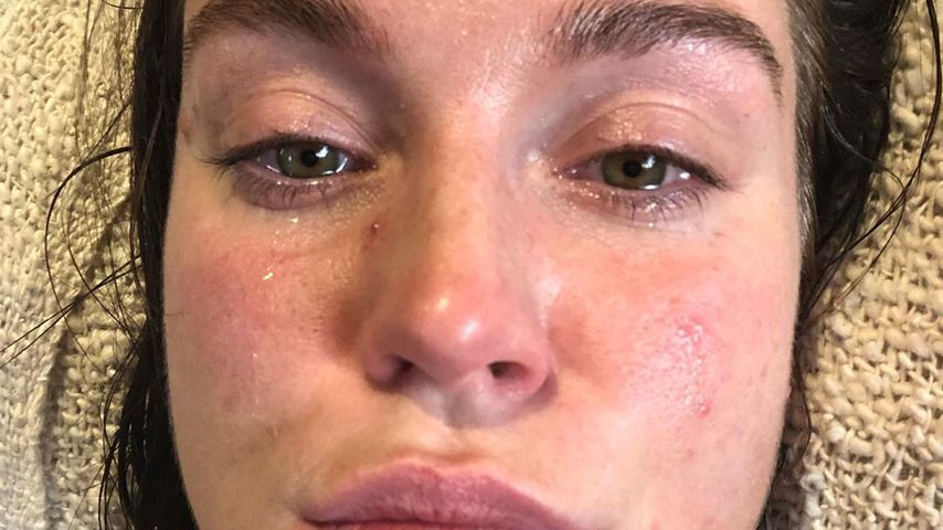 Besuch in Kinderwunsch-Klinik: Vicky Pattison bereut Exzesse