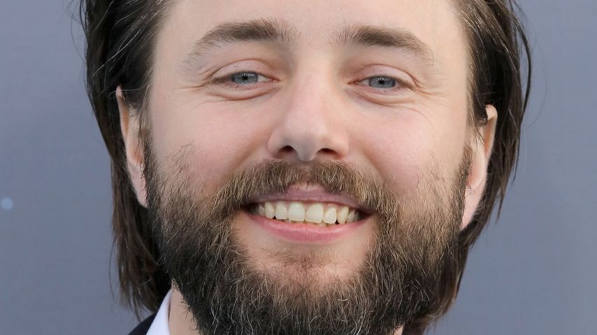 Warum nur? "Mad Men"-Star hat Haaransatz rasiert