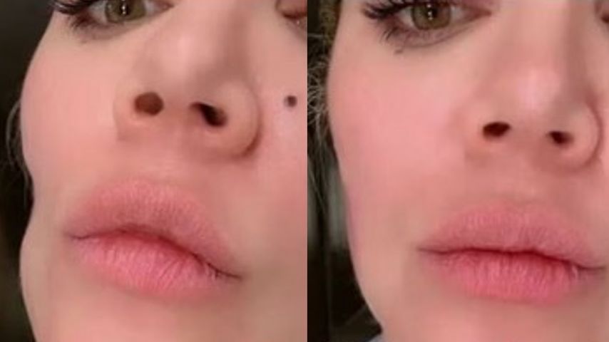 Khloé Kardshian, Vorher-Nachher-Collage