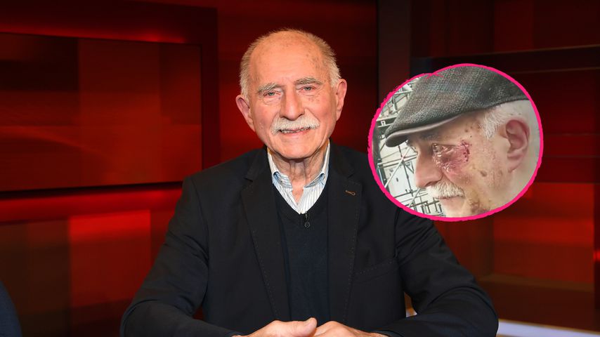 "Wird wieder": "Promi Big Brother"-Werner hatte OP am Auge