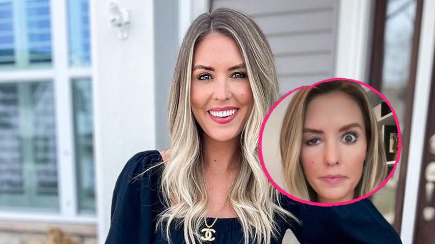 Botox-Unfall: Influencerin kann ihr Auge nur halb öffnen!