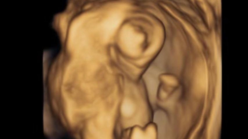 Whitney Cummings' Baby im Bauch