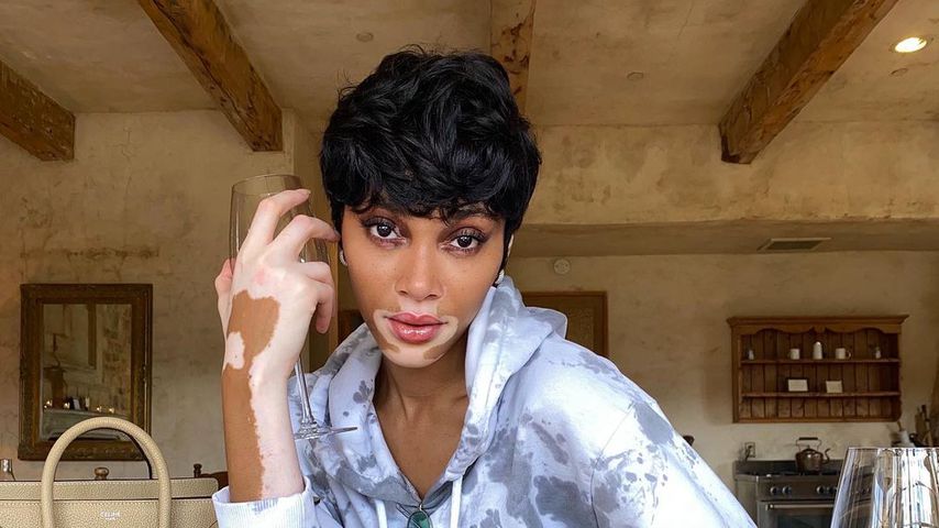 Hot or not? Winnie Harlow trägt jetzt einen Kurzhaarschnitt