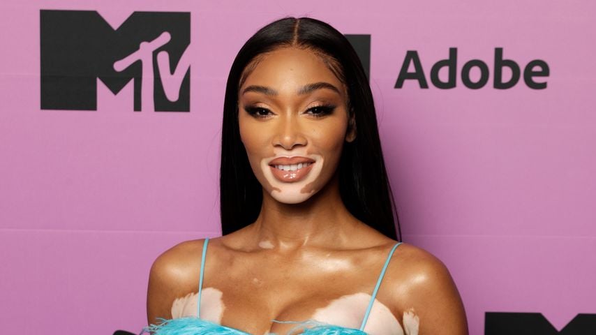 Model Winnie Harlow