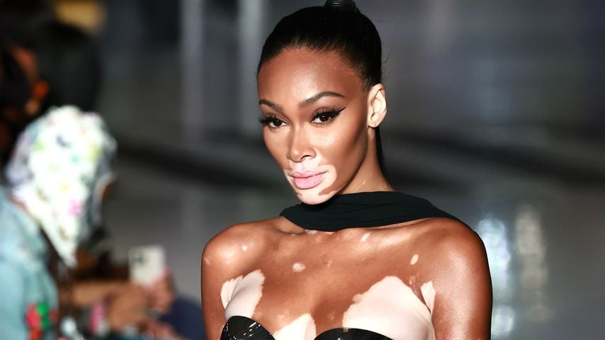 Inspirierend: Winnie Harlow posiert nackt für Magazincover!