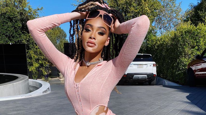 Winnie Harlow, Model
