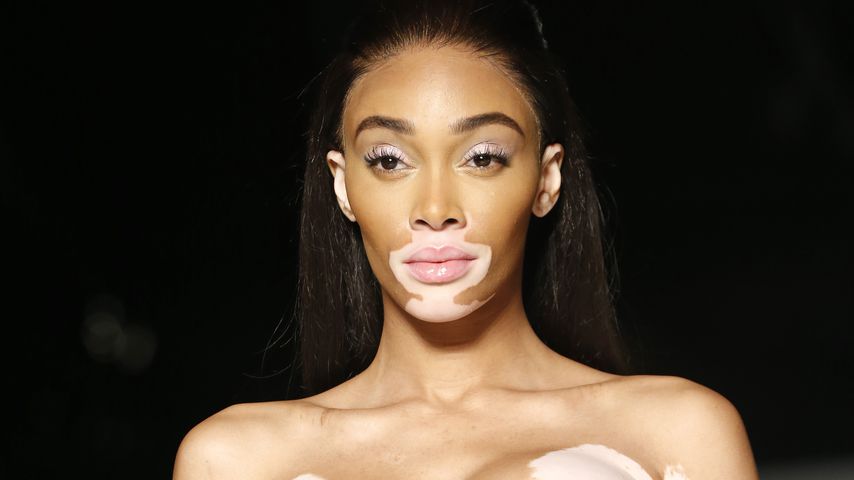 Winnie Harlow im Januar 2020 in Paris