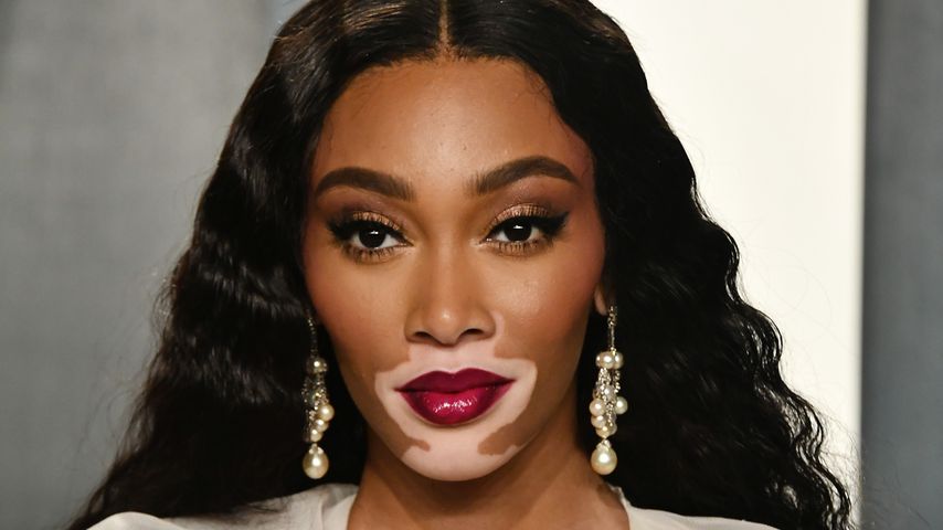 Winnie Harlow im Februar 2020