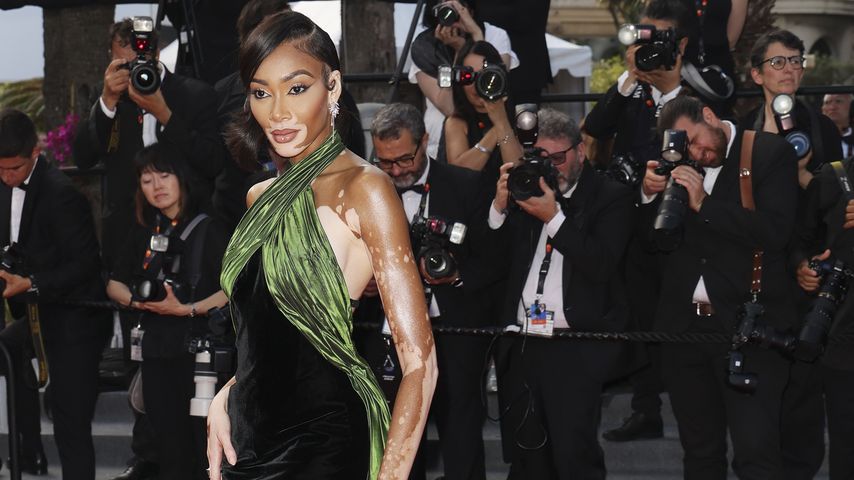 Winnie Harlow, Model