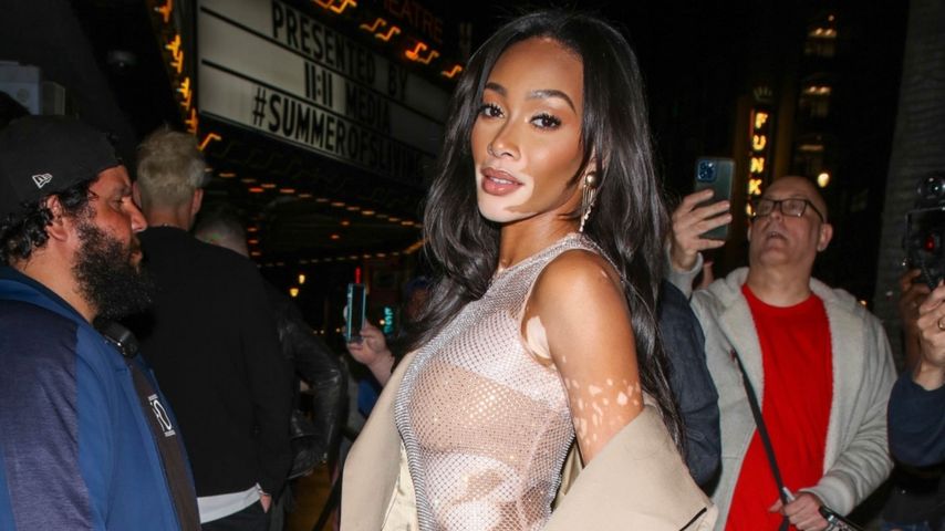 Winnie Harlow beim Paris-Hilton-Konzert in Hollywood