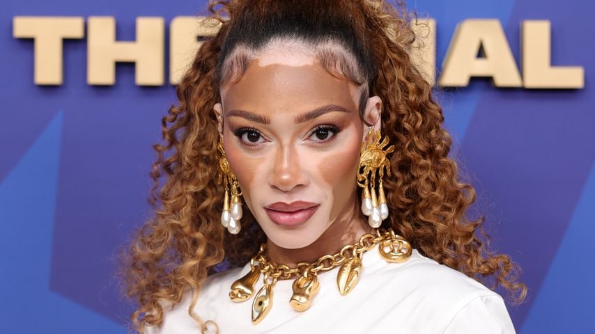 Transparenter Zebra-Look: Winnie Harlow sorgt für Aufsehen