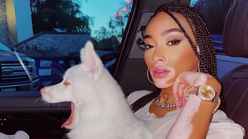 Winnie Harlow im Mai 2020
