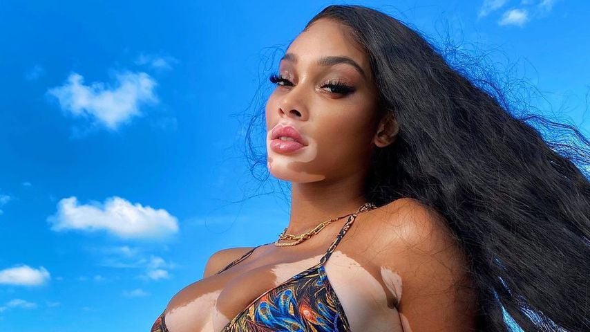 Winnie Harlow im März 2021