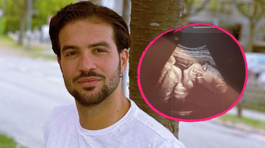 Baby-Endspurt: "Love Island"-Yasin postet Ultraschallbild