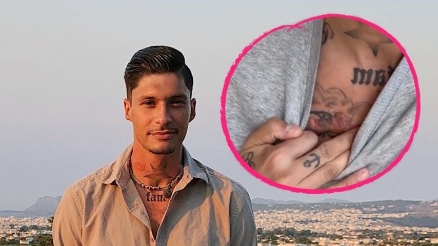 Das steckt hinter "Kampf der Realitystars"-Yasins Brustnarbe