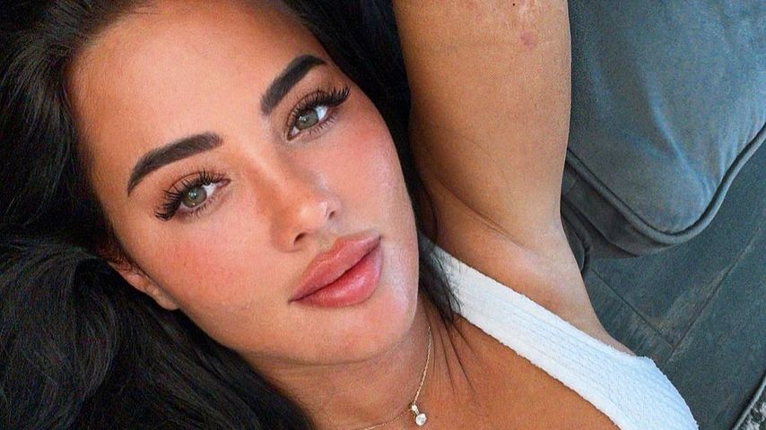 Nach dem Horror-Unfall: Yazmin Oukhellou zeigt ihre Narben