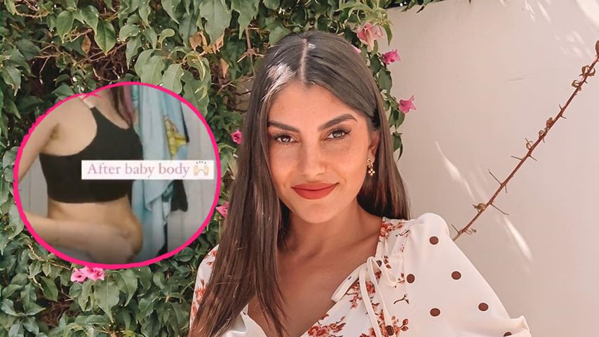 Extrem ehrlich: Yeliz Koc steht zu ihrem After-Baby-Body