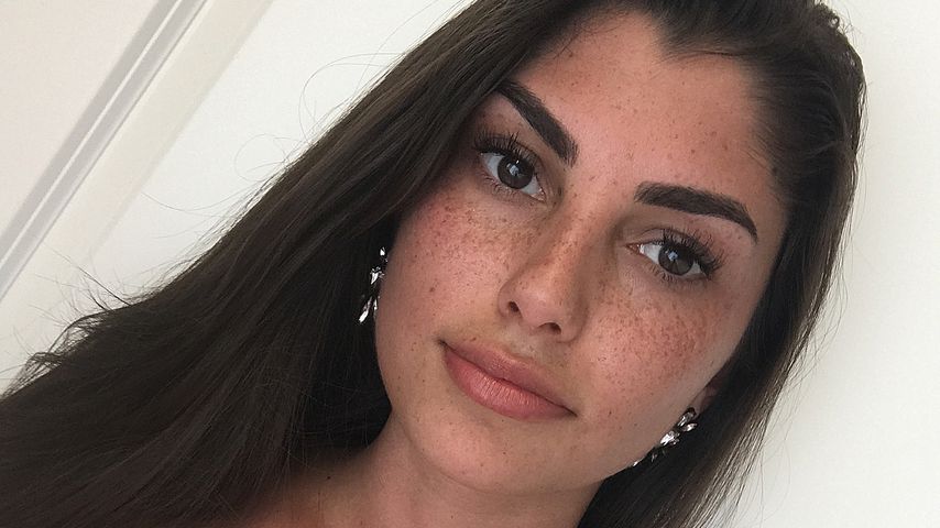 Ganz schön blutig: Hier zeigt Yeliz Koc Bilder ihrer Fuß-OP