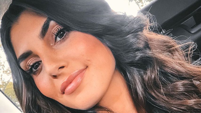 Aus Angst vor Nadeln: Auf diese Beauty-OP verzichtet Yeliz