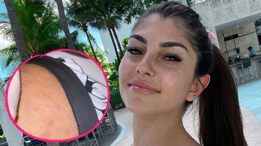 After-Baby-Body: Yeliz Koc steht zu ihren Dehnungsstreifen