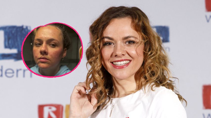 Nach langem Urlaub: Yvonne Pferrers "Haut ist explodiert"