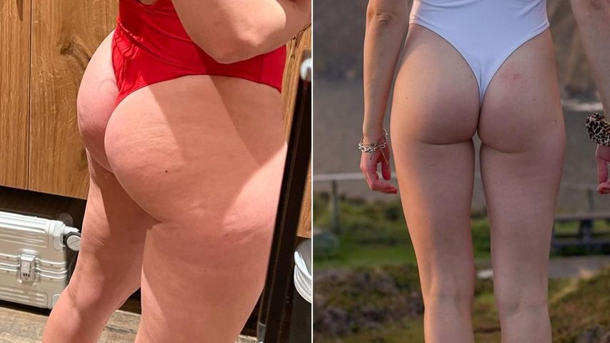Yvonne Pferrers Beine bevor und nach einer Sporttransformation